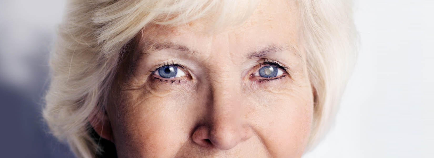 Cataract Surgery in Owensboro